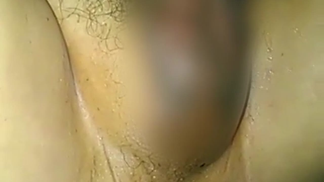 内診台　浣腸　医療プレイ 野外浣腸・脱糞 スカトロ動画無料サンプル、配信 ストリーミング B10F.jp 地下10階・ビーテンエフ